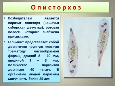 Котокафе «Murchim» - Описторхоз или кошачья двуустка. Беседа на тему о том,  как живется коту в Сибири и как живется его глистам, а также как не  заводить себе и коту таких соседей.