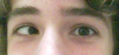 Странная девушка косит глаза на предпосылке изолированной белизной Стоковое  Изображение - изображение насчитывающей наг, рот: 103787455