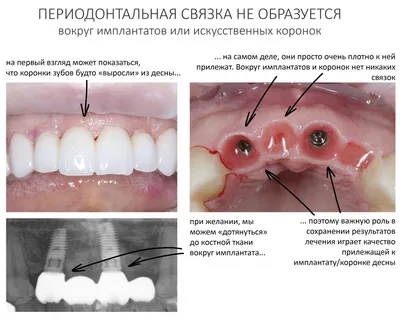 Стоматология. Понятная и Доступная. — LiveJournal