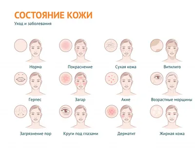 Что делать, если шелушится кожа ≡ Блог MED CITY | Как быстро убрать  шелушение кожи в Киеве