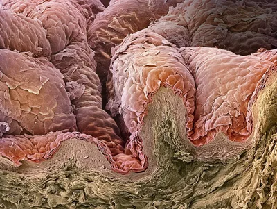 🔬 кожа под микроскопом, …» — создано в Шедевруме