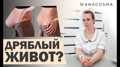 👍 Как убрать живот после родов 😱Дряблая кожа👍Советы доктора 👍 - YouTube