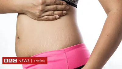 Крем массажный от растяжек, для беременных и после родов, с экстрактом  центеллы, 130 мл купить по низким ценам в интернет-магазине Uzum (591231)