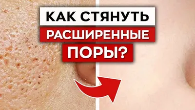 Расширенные поры: как сделать менее заметными