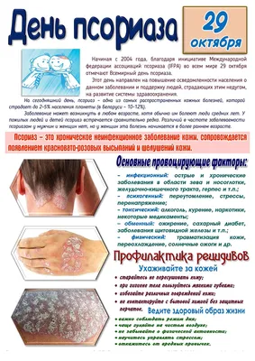 Диагноз кожных заболеваний - аллергий, псориаза, Eczema, дерматита  Дерматолог с перчатками рассматривает кожу больного Стоковое Изображение -  изображение насчитывающей доктор, экзема: 154129127