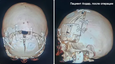 Краниостеноз: врачи, клиники, цены | Russian Hospitals