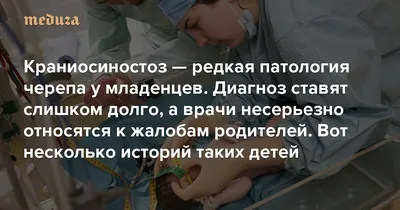 Краниосиностоз: что это, причины заболевания, симптомы, диагностика и  лечение