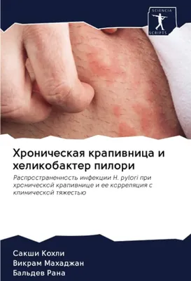 Лечение крапивницы у детей в Приморском районе СПб