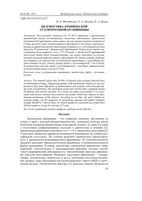 Крапивница у взрослых: причины, симптомы, лечение, профилактика в домашних  условиях