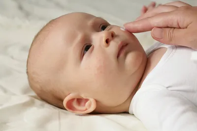 Сыпь на голове у ребенка, как лечить? Появилась сыпь у месячного ребёнка |  MedAboutMe