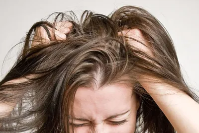 Специалист-эксперт: Стресс - значимый фактор, способствующий выпадению  волос - АЗЕРТАДЖ