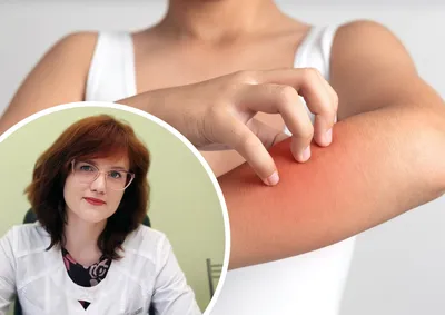 Сыпь на теле - причины, симптомы и лечение высыпаний на коже | Mriya Med