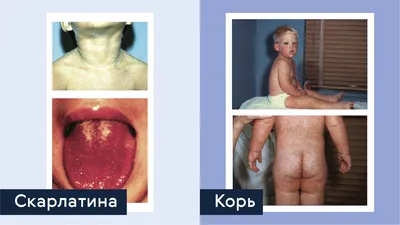 Нервный дерматит (8 фото): причины, симптомы, виды, лечение, профилактика –  Лостерин