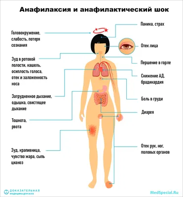 Высыпания на коже при беременности - Иркутский городской перинатальный  центр имени Малиновского М.С.