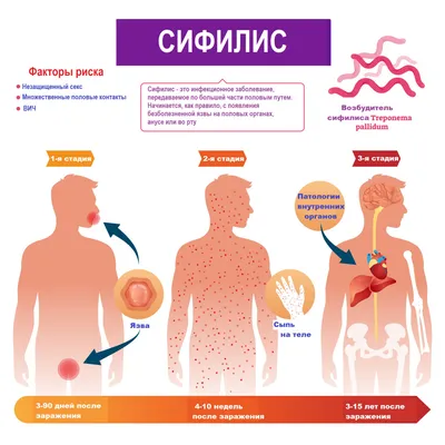 Лимфаденопатия — Википедия