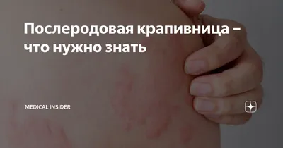 Послеродовая крапивница – что нужно знать | Мedical Insider | Дзен