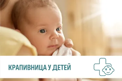 Аллергия у грудничка — 51 ответов | форум Babyblog