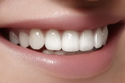 Красивая форма зубов - 78 фото