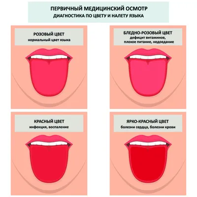 Изменение слизистой оболочки полости рта при сердечно-сосудистых  заболеваниях