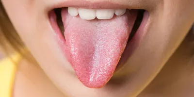 Гематома в полости рта: причины, симптоматика явления и способы лечения |  Cтатьи от стоматологии АО Медицина