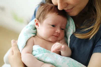Родимые пятна на теле ребенка: какие бывают, чем опасны, как лечить -  Parents.ru | PARENTS