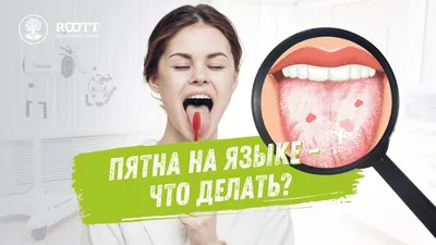 Стоматит – что это, как и чем лечить у взрослых, симптомы, причины