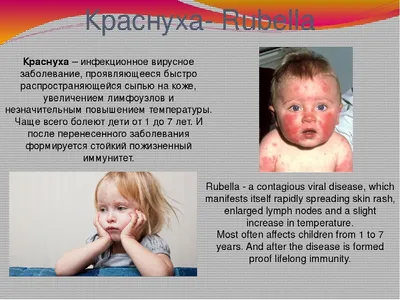 Корь у детей: Вспышка кори в России в 2023 году 🤒 - Евромед Кидс
