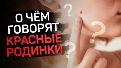 Красные точки на теле. Гемангиомы. Ангиомы. Что делать с красными точками  на КОЖЕ? — Видео | ВКонтакте