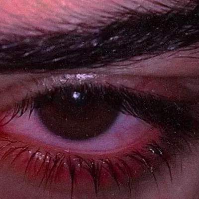 Красные глаза: причины возникновения и как избавиться | Почему? | Дзен