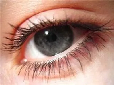 Красные глаза у ребенка 👀 Информационный портал Детское зрение