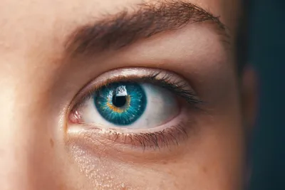 Focus Clinic - 👉🏻Красные глаза Причиной красных глаз могут стать  недостаточное количество сна, длительная работа, воздействие ветра или  солнца. Если глаза становятся красными без особых причин, то с высокой  вероятностью можно говорить