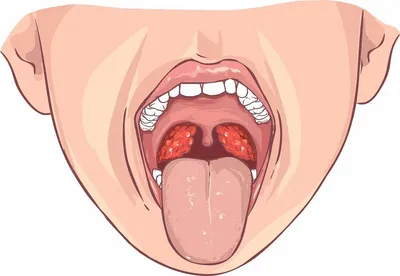 Пигментные изменения слизистой оболочки полости рта - parodont.pro