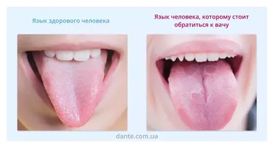 Что язык говорит о нашем здоровье?