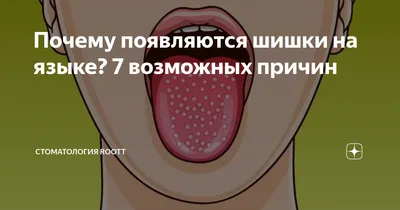 Скарлатина у взрослых: признаки, симптомы, диагностика, как передается,  лечение