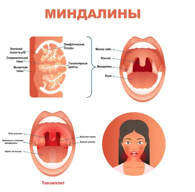 Под языком появились кровоточащие полоски, как это лечить? — Москва