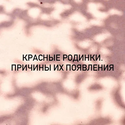 Гемангиома (красная родинка) » Клиника косметологии и дерматологии  «ACADEMY» — лечение кожи и волос.