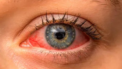 Диабет глаза: что это такое, причины, симптомы, лечение