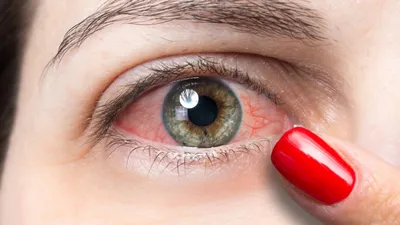 Крупный план глаза с красным пятном. | Премиум Фото
