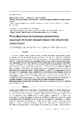 Изучение эффективности лекарственной композиции для лечения  эрозивно-язвенной формы красного плоского лишая слизистой полости рта –  тема научной статьи по клинической медицине читайте бесплатно текст  научно-исследовательской работы в электронной ...