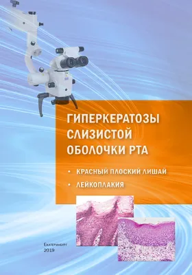 Красный плоский лишай. Харьков - Центр европейской дерматологии