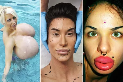 Кристина Рэй и ее самые большие в мире губы, фото до и после
