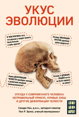 Как исправить прикус без брекетов? - Статьи компании Реал Дент