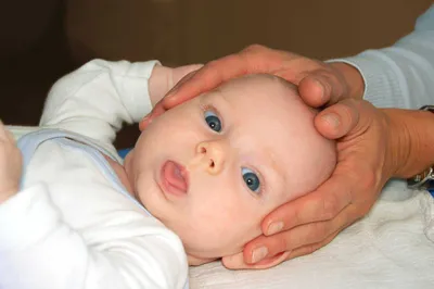 Остеопатическое лечение при кривошеи у младенцев » Остеопатическая  ассоциация Кыргызской Республики