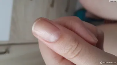 Наращивание ногтей на кривых пальцах - YouTube