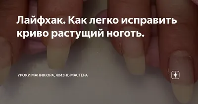 Ответы Mail.ru: Кривые ногти на руках
