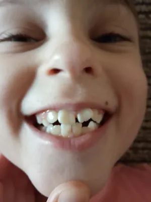 Кривые зубы - приговор? | Mrs.Hamster | Дзен