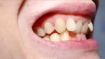 У ребенка растут кривые молочные зубы? Специалисты клиники «Династия-С» в  Росто-ве легко справляется с проблемой.