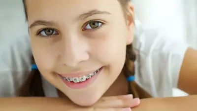 6 странностей, которые происходят с детскими зубами