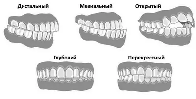 Дистопия. Дистированные клыки