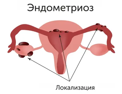 Как восстановить работу печени и желчного пузыря. | Диетолог Лилия  Стародубцева | Дзен